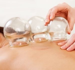 Cupping massage on the back