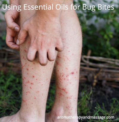 Essential Oils for Bug Bites Person scratching leg covered with insect bites | Essential Oils for Bug Bites