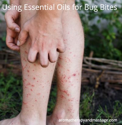 Person scratching leg covered with insect bites | Essential Oils for Bug Bites